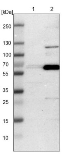 GDF-5/BMP-14 Antibody, Novus Biologicals 0.1mL; Unlabeled:Antibodies, Polyclonal